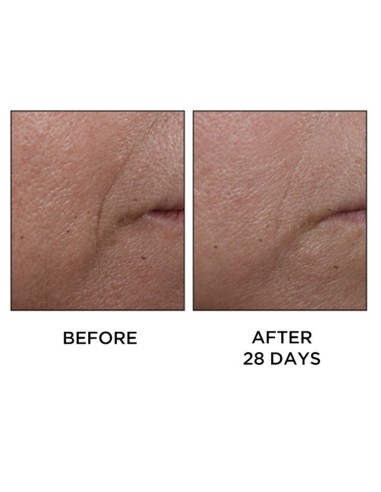 Cold Plasma Plus+ Face
