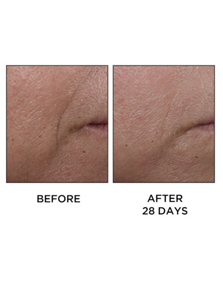 Cold Plasma Plus+ Face