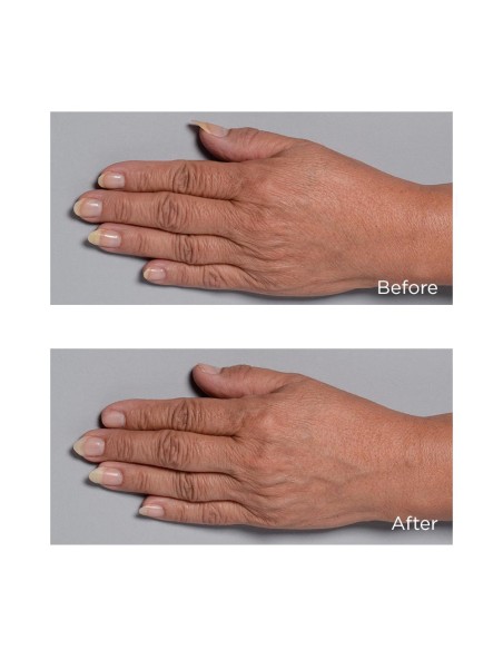 Cold Plasma Plus+ Hand Therapy