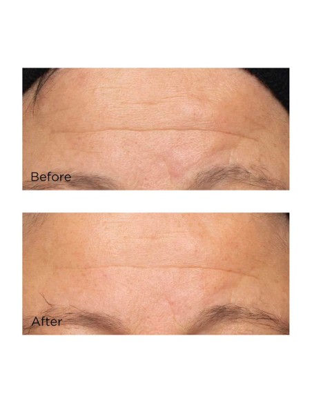 Cold Plasma Plus+ The Intensive Hydrating Complex