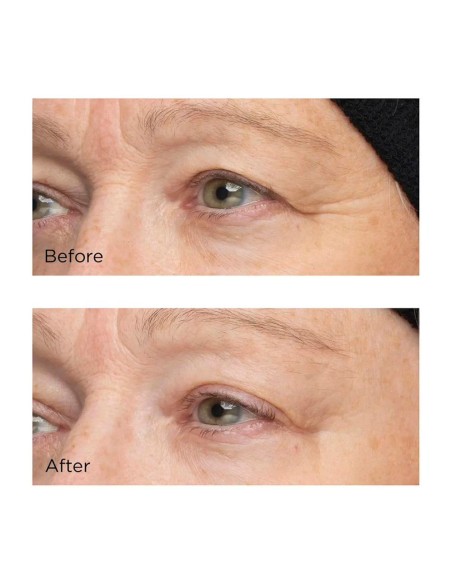 Cold Plasma Plus+ The Intensive Hydrating Complex