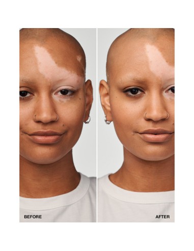 Even Better Clinical Serum Fundation...