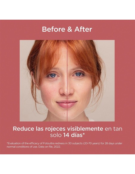 FotoUltra Redness SPF 50+