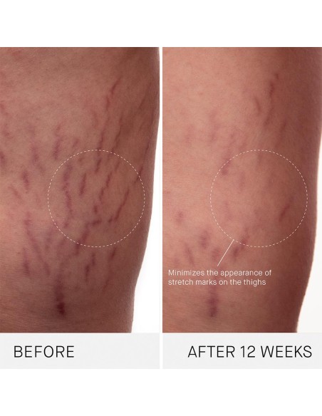 The Body Cream