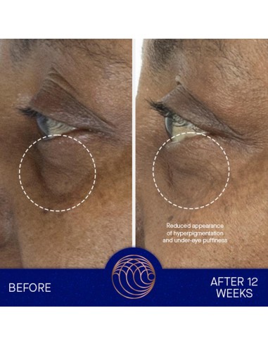The Eye Cream