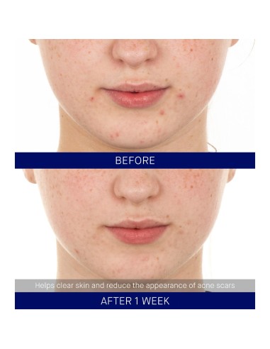 The Retinol Serum