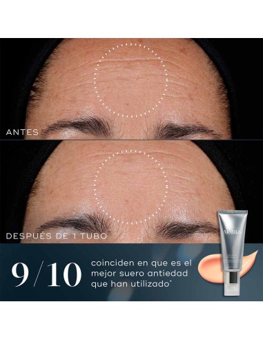 Crystal Retinal 3