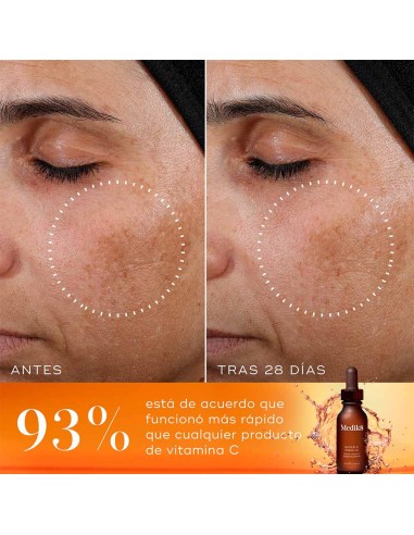 Super C Ferulic
