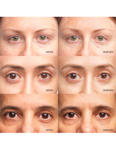 All About Eyes Brightening Serum