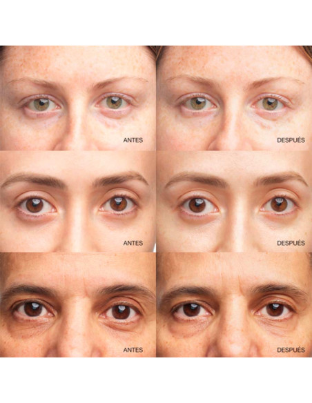 All About Eyes Brightening Serum