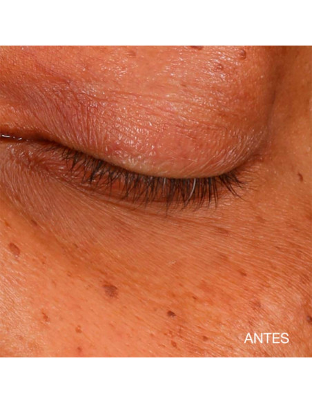 All About Eyes Brightening Serum
