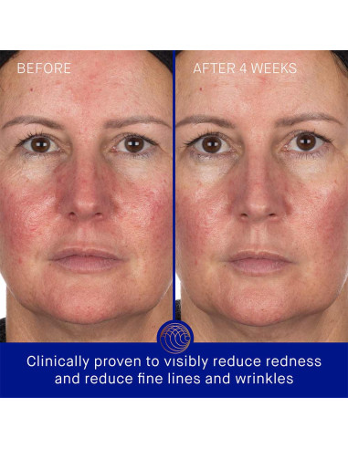 The Hydrogel Face Mask