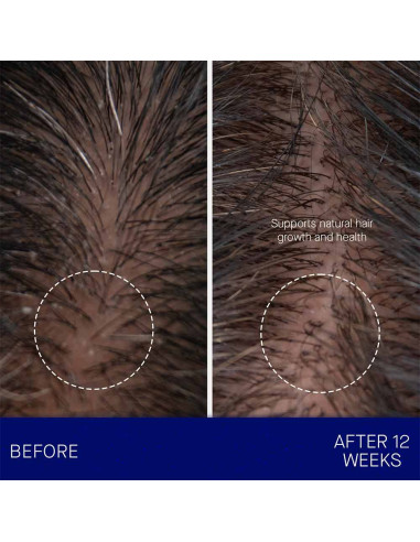 The Leave In Hair Treatment