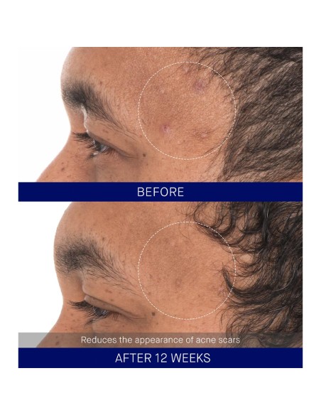The Retinol Serum